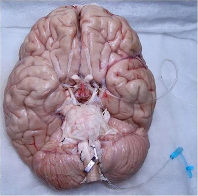 Latex vascular injection as method for enhanced neurosurgical training and skills
